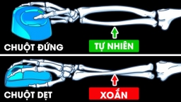 5 lý do vì sao bạn nên dùng chuột máy tính đứng