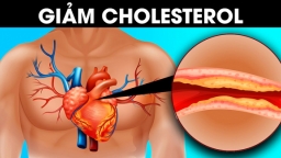 5 thay đổi trong lối sống giúp giảm cholesterol, hạn chế nguy cơ bệnh tim, đột quỵ