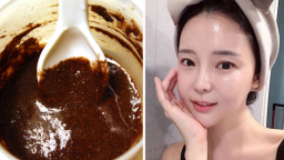 5 cách trị mụn trứng cá bằng nguyên liệu tự nhiên tại nhà không cần đến spa