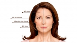 Collagen Yến sào - Khiến bạn đẹp hơn từng khoảnh khắc