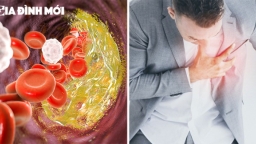 6 thói quen xấu khiến cholesterol tăng cao, bệnh tật gõ cửa