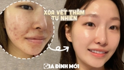 5 mẹo đơn giản nhưng hiệu quả giúp xóa vết thâm trên da bằng nguyên liệu tự nhiên tại nhà