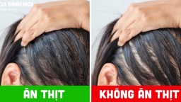 Tự nhiên, đơn giản, tiết kiệm: 6 cách ngăn rụng tóc, kích thích tóc mọc nhanh và dày hơn