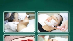 Có nên đến spa trị mụn hay không? Nguyên nhân gây ra mụn