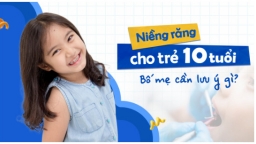 Trẻ 10 tuổi có nên niềng răng không? Bố mẹ cần lưu ý những gì?