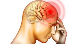 Nhiều người bị thiếu máu lên não nhưng không biết, chỉ nghĩ đau đầu bình thường, 5 dấu hiệu nhận biết thiếu máu não