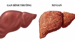 Ăn kiêng, uống sinh tố, làm sạch đại tràng có giúp 'giải độc gan’?