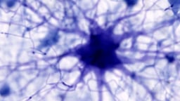 Trí tuệ nhân tạo mang đến hy vọng tìm ra phương pháp điều trị bệnh Alzheimer