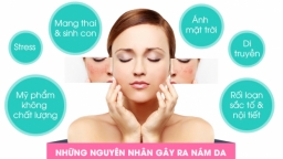 'Điểm mặt' lý do phụ nữ sau khi sinh thường hay bị nám, sạm da, lão hóa?