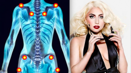 Bí mật về căn bệnh ‘đau đớn khủng khiếp’ khiến Lady Gaga phải hoãn lưu diễn Châu Âu