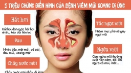 Nguyên nhân, triệu chứng điển hình và cách điều trị bệnh viêm mũi xoang dị ứng