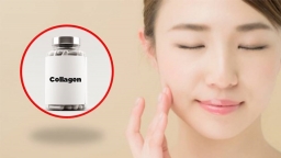 Thực phẩm chức năng collagen không thực sự tốt như quảng cáo?