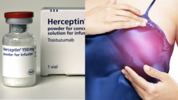 Nghiên cứu mới: Thuốc Herceptin giúp rút ngắn một nửa thời gian điều trị ung thư vú