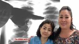 Những biến chứng và diễn biến nguy hiểm của bệnh ung thư phổi mà diễn viên Mai Phương mắc phải