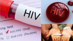 Phát hiện thêm 3.500 trường hợp nhiễm HIV, đang có 130.000 bệnh nhân điều trị ARV