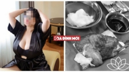 Hotgirl ngực 'khủng' đã phẫu thuật thu nhỏ, hút mỗi bên 1kg mỡ