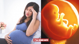 Bà bầu bị đau đầu buồn nôn có nguy hiểm không?