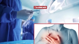 'Lây' bệnh ung thư từ người hiến tạng, 3 người nhận tạng bị tử vong