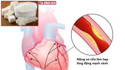 Người bị bệnh động mạch vành có nên ăn đường không?