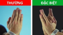 Hãy thử bài test để xem bạn đặc biệt tới mức nào?