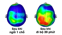 18 mẹo học tập giúp nâng cao trí nhớ để đạt kết quả cao nhất trong kỳ thi