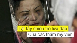 Thẩm mỹ viện lừa đảo: Những chiêu trò được tiết lộ bởi bác sĩ ngành thẩm mỹ