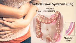 Hội chứng ruột kích thích (IBS) là gì? Các triệu chứng báo động và cách điều trị