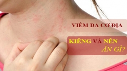 Viêm da cơ địa kiêng ăn gì để hỗ trợ điều trị bệnh hiệu quả nhanh hơn?