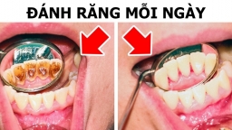 8 sai lầm lớn nhiều người hay mắc phải khi chăm sóc răng miệng