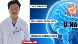 Hay đau đầu, buồn nôn, yếu tê bì... là dấu hiệu của bệnh u não