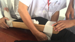 7 bước sơ cứu nạn nhân tai nạn thương tích, tuyệt đối không chở đi viện bằng xe máy