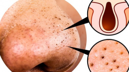 10 bước chăm sóc giúp bạn gái sở hữu làn da thủy tinh, căng bóng đúng chuẩn Hàn Quốc