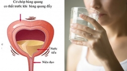 Nước rất tốt nhưng cách uống sai lầm phổ biến lại gây hỏng bàng quang cần tránh xa