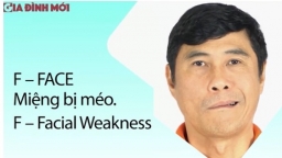 Cần làm gì khi bị đột quỵ? Hướng dẫn cách sơ cứu cho người đột quỵ theo tư vấn của bác sĩ