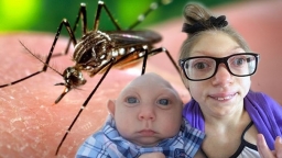 Virus Zika là gì? Triệu chứng và cách phòng chống virus Zika