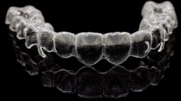 Sự thật bất ngờ về phương pháp niềng răng Invisalign từ Mỹ