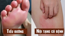 6 vị trí ngứa ngáy trên cơ thể cảnh báo nội tạng ứ đọng độc tố, bệnh tật đầy trong người