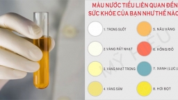 Vì sao nước tiểu màu vàng, màu sắc nước tiểu nói gì về sức khỏe của bạn?