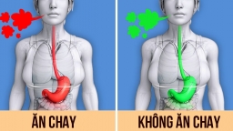 10 điều có thể xảy ra với cơ thể khi bạn ăn chay