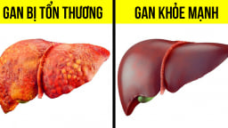 5 thói quen ăn uống tốt nhất cho gan theo chuyên gia dinh dưỡng
