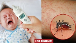 Trẻ sốt 38 - 39 độ, làm sao biết con đang mắc sốt virus, sốt xuất huyết hay cúm B?