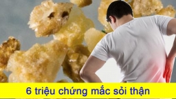 6 triệu chứng mắc sỏi thận, ai thấy cần đi khám ngay kẻo muộn