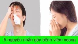 6 nguyên nhân 'rước' bệnh viêm xoang vào người, biết để phòng tránh ngay từ hôm nay