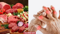 5 thói quen ăn uống dẫn đến bệnh gout, cần bỏ ngay nếu không muốn chịu đau đớn