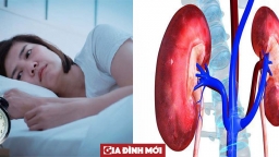 Dấu hiệu của bệnh thận diễn ra rất âm thầm, phải để ý mới phát hiện, thấy 7 triệu chứng sau thì đi khám sớm nếu không muốn suy thận