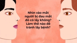 Nhìn vào mắt người bị đau mắt đỏ có lây không? Làm thế nào để phòng tránh?