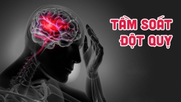 8 đối tượng, 6 triệu chứng cần đi tầm soát đột quỵ ngay kẻo muộn