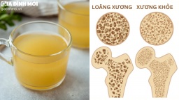7 loại nước uống lành mạnh giúp xương chắc khỏe