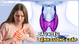 18 dấu hiệu cảnh báo bệnh cường giáp