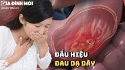 6 dấu hiệu điển hình cảnh báo bạn bị đau dạ dày